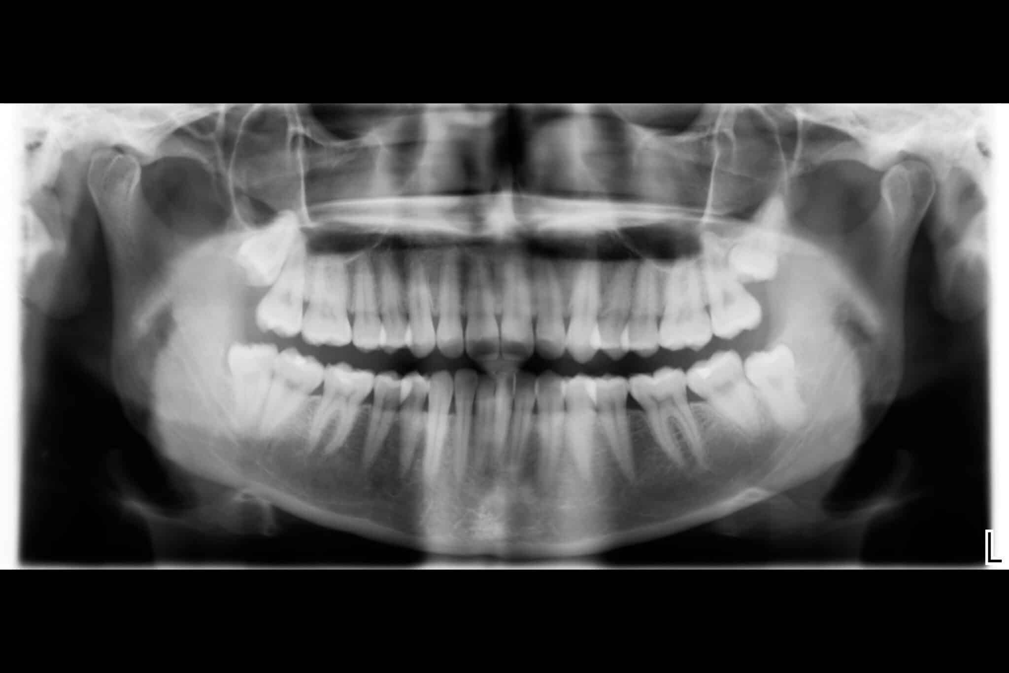 Ved Kolbotn Tannklinikk tar tannleger panoramarøntgen (OPG) – helhetlig oversikt i Kolbotn, Vinterbro og Follo.