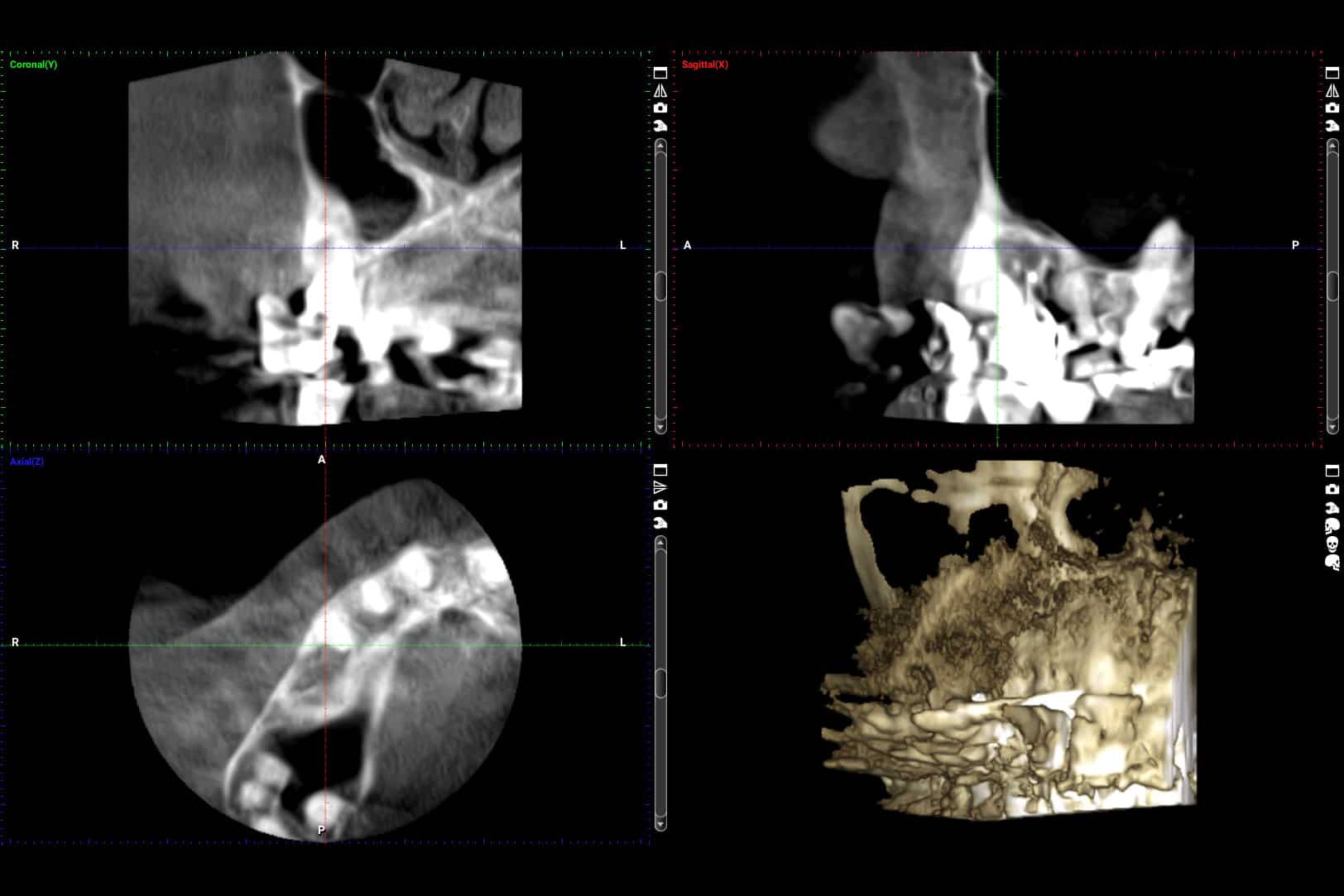 CBCT 3D-røntgen hos Kolbotn Tannklinikk – avansert teknologi for tannbehandling i Kolbotn, Follo, Greverud og Holmlia.