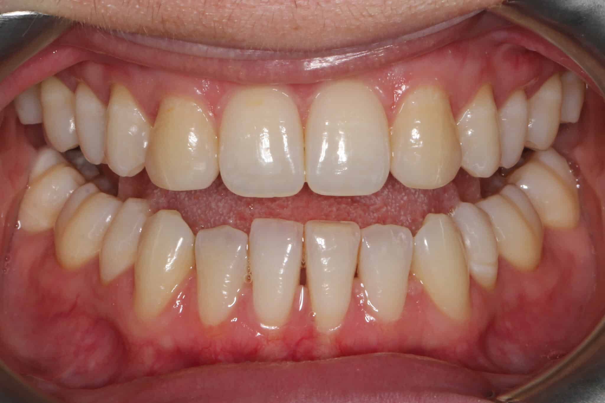 Ved Kolbotn Tannklinikk tar tannleger OPG panoramarøntgen for helhetlig oversikt over kjeve, tenner og bihuler – brukt i Kolbotn, Follo og Nordstrand.