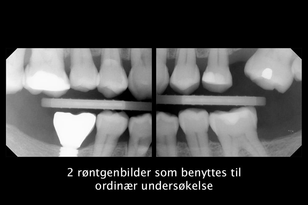 Hos Kolbotn Tannklinikk benyttes digitale røntgenbilder for tidlig oppdagelse av tannskader – moderne tannklinikk i Kolbotn, Myrvoll og Holmlia.