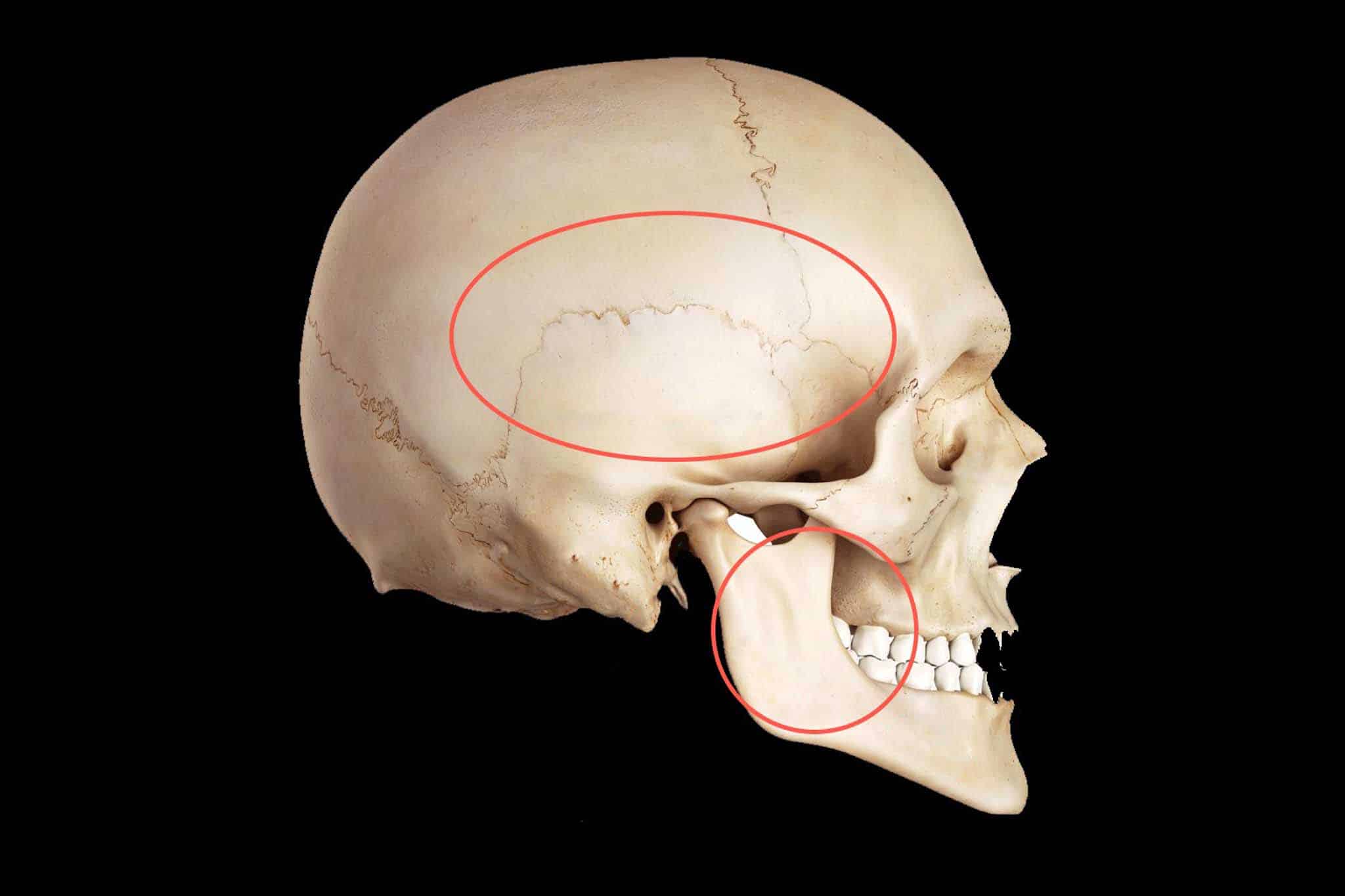 Slider som viser tyggemuskelområdet (i rødt) og kjeveledd/diskusområdet (lilla).