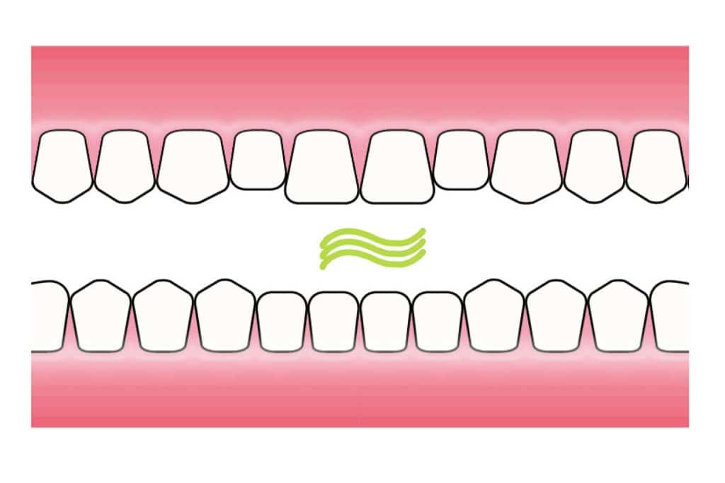 Hos Kolbotn Tannklinikk forklares hvordan dårlig ånde oppstår fra utpust – Kolbotn, Follo, Oppegård og Nordstrand.