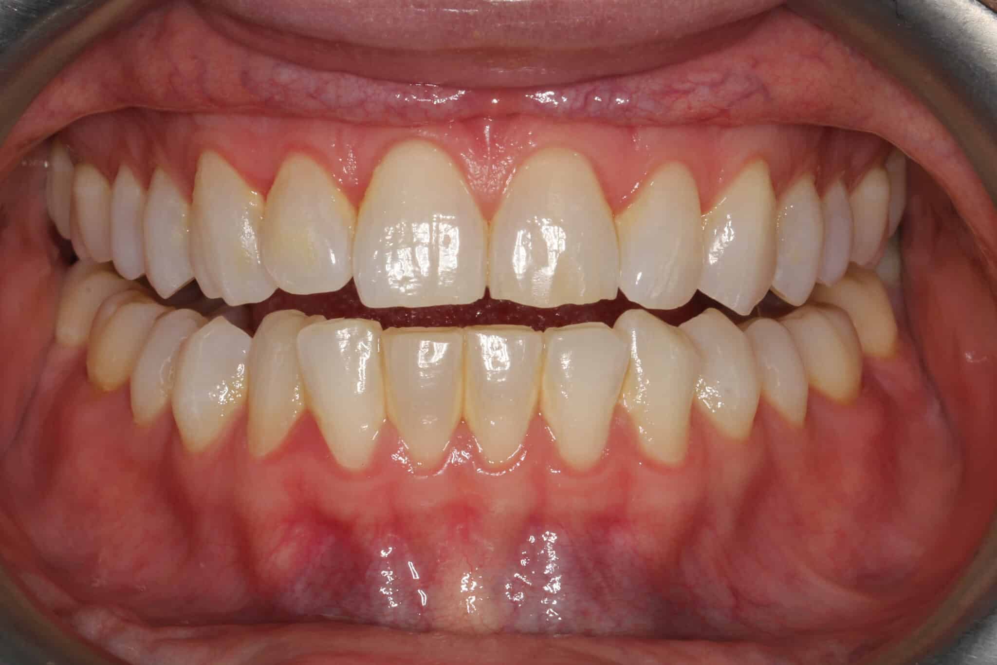 På Kolbotn Tannklinikk bruker tannlegene illustrasjoner som viser tydelig forskjellen mellom friskt tannkjøtt (grønt) og betent tannkjøtt (rødt).