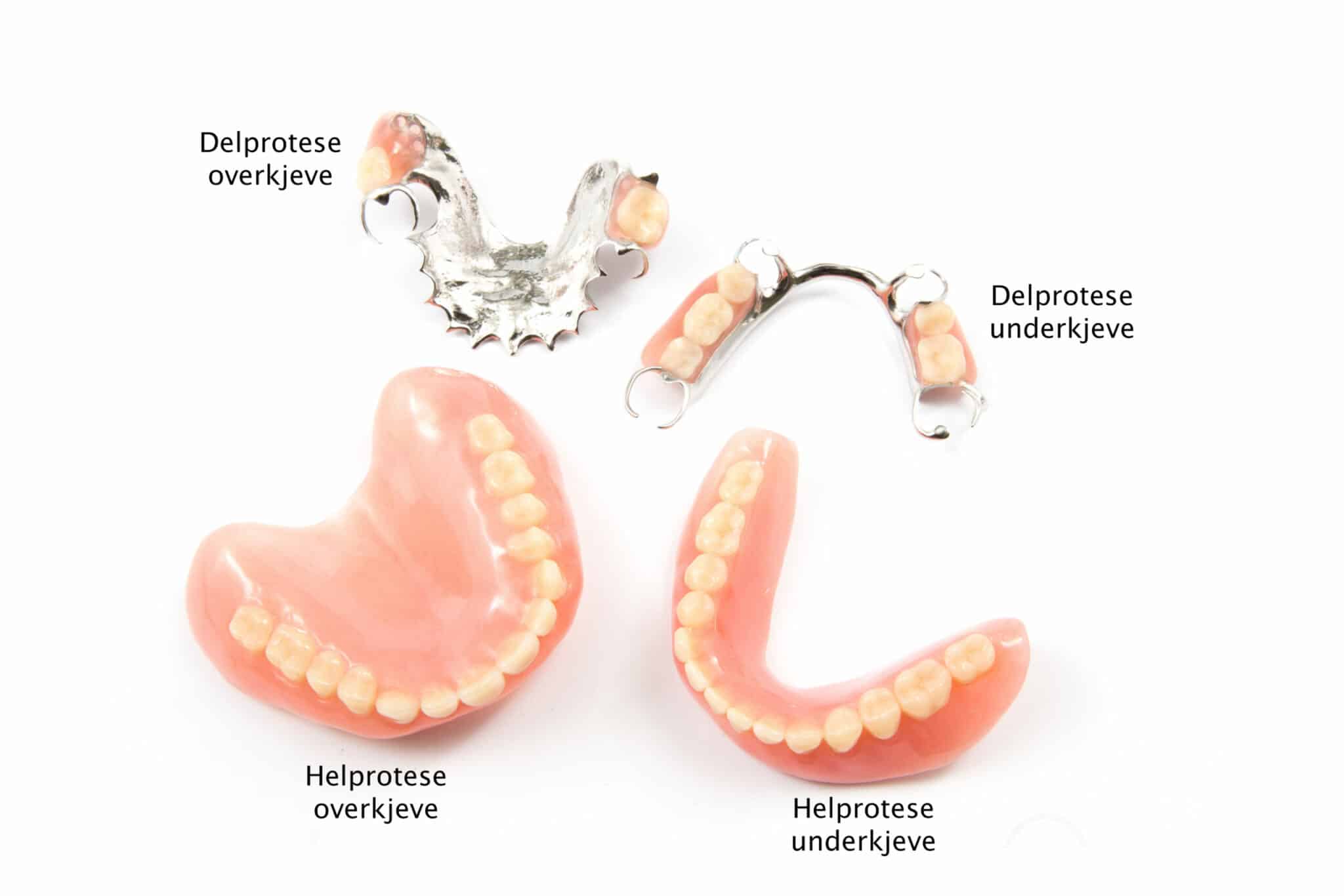 Galleri: På Kolbotn Tannklinikk brukes delprotese og helprotese som rimelig tannerstatning – behandling i Kolbotn, Vinterbro og Sofiemyr.