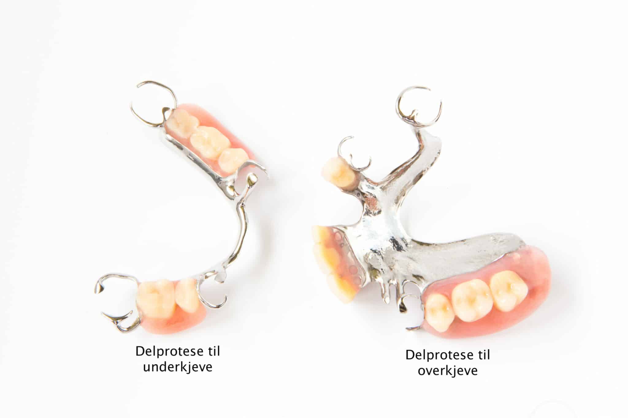Hos Kolbotn Tannklinikk brukes kromkobolt som permanent løsning ved delprotese – behandling i Kolbotn, Follo og Sofiemyr.