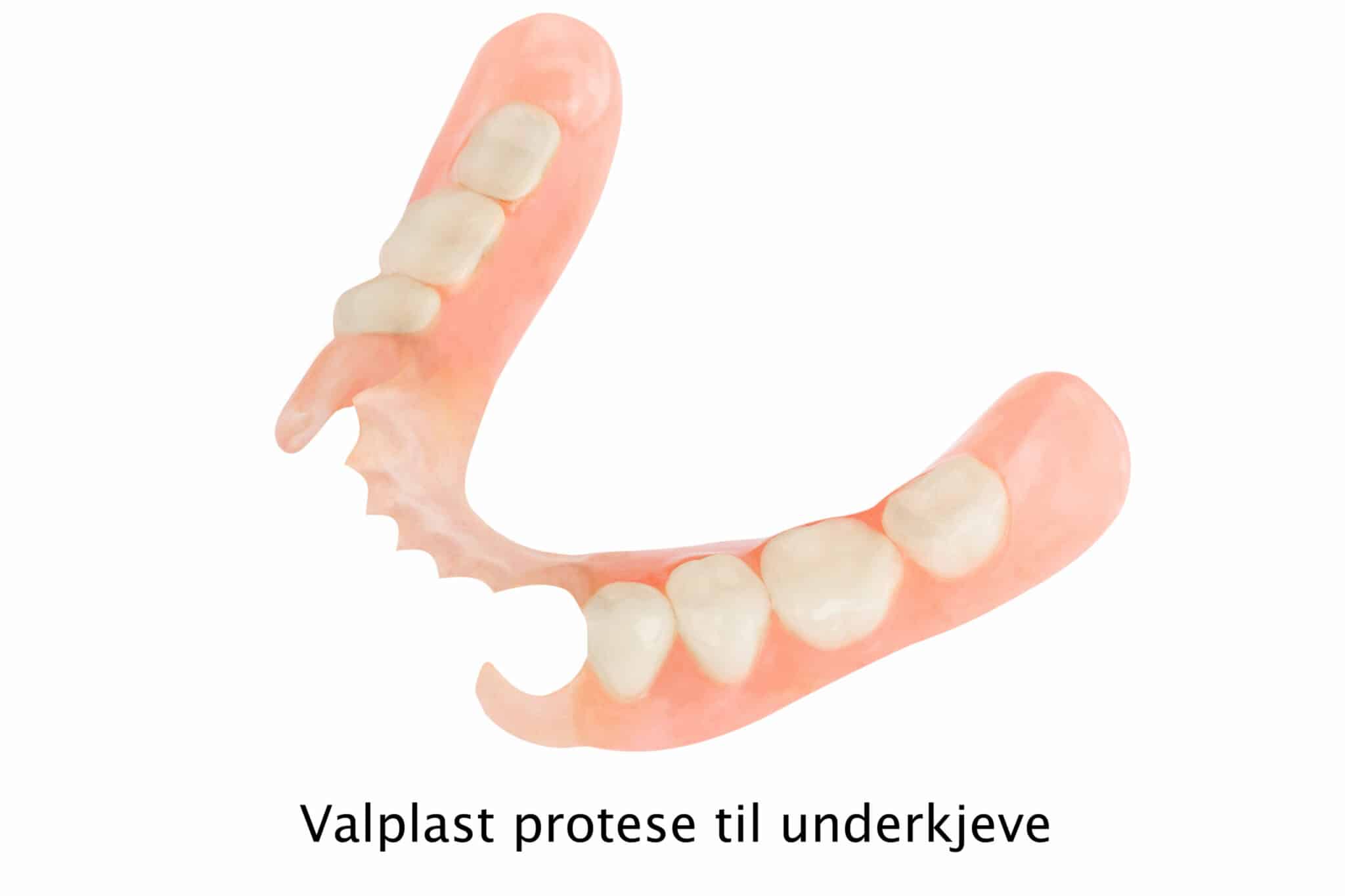 På Kolbotn Tannklinikk brukes valplast delprotese som midlertidig løsning – behandling i Kolbotn, Vinterbro og Holmlia