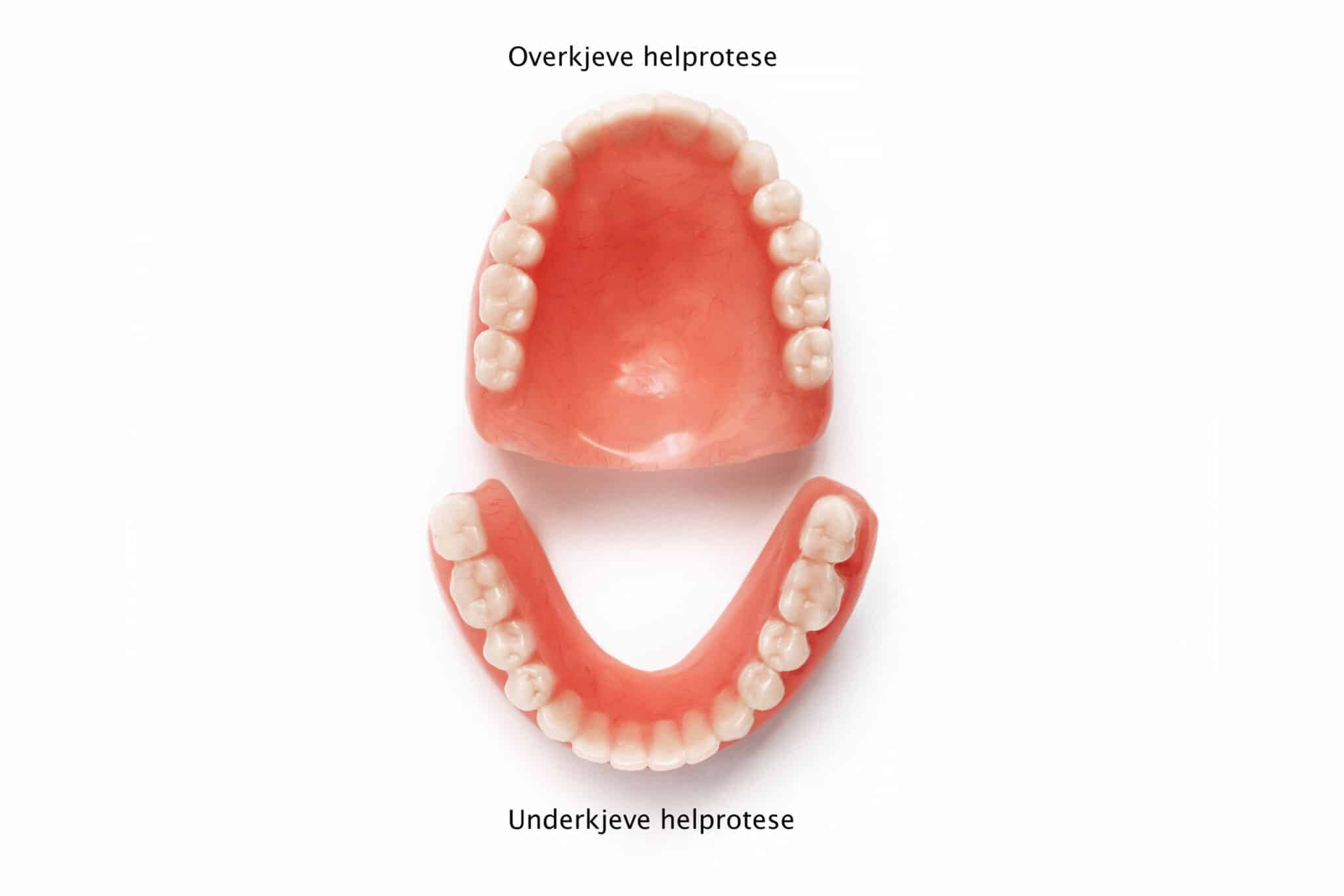Før- og etterbilde: På Kolbotn Tannklinikk fremstilles helproteser for både overkjeve og underkjeve – moderne tannerstatning i Kolbotn, Vinterbro og Holmlia.
