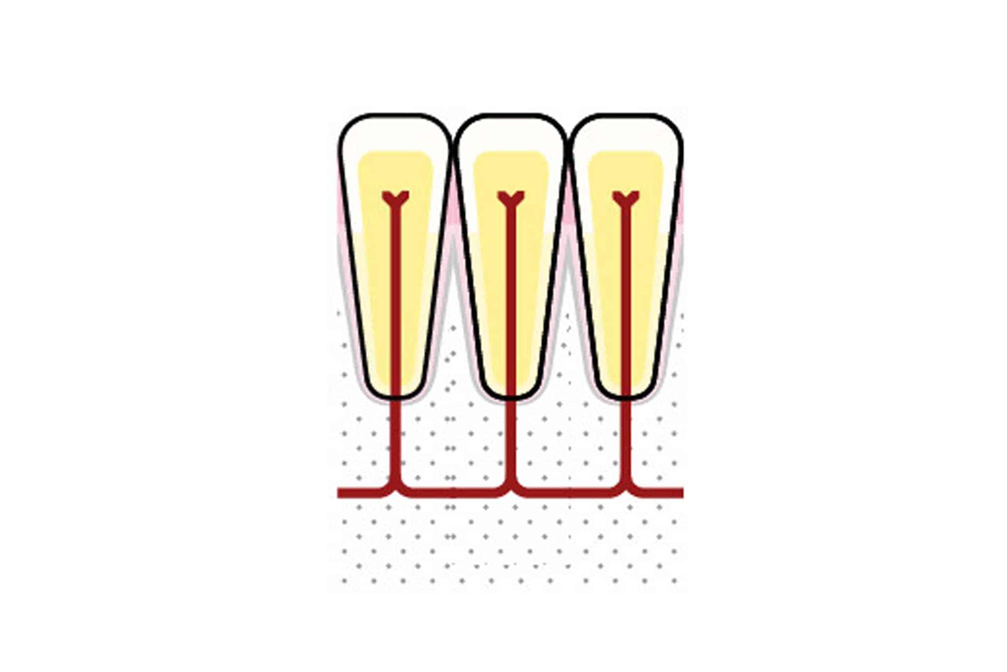 Illustrasjon av frisk tann og tann med pulpitt.