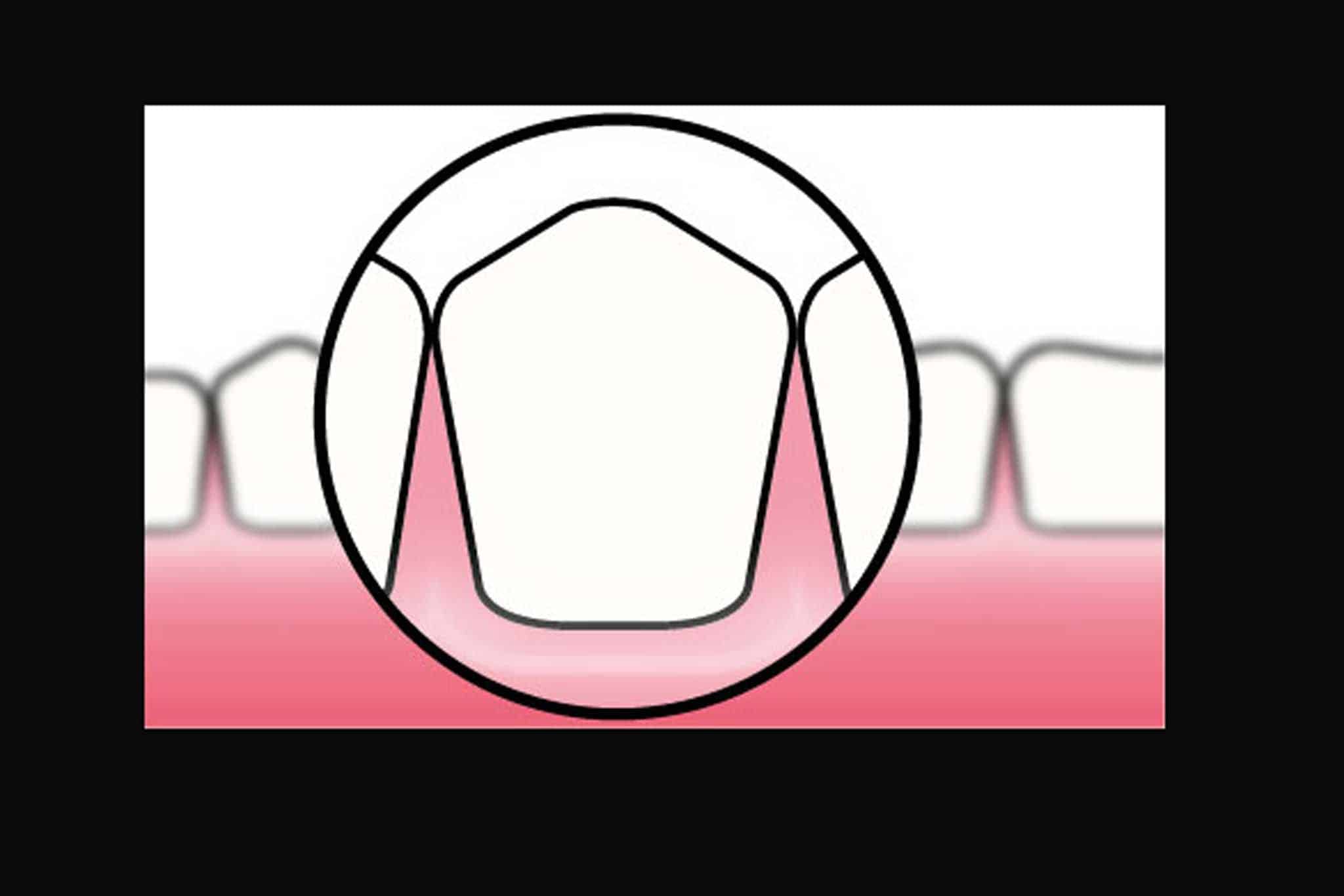 Før- og etterbilde: Mikroskop brukt ved Kolbotn Tannklinikk gir tannleger i Kolbotn og Follo enestående presisjon.