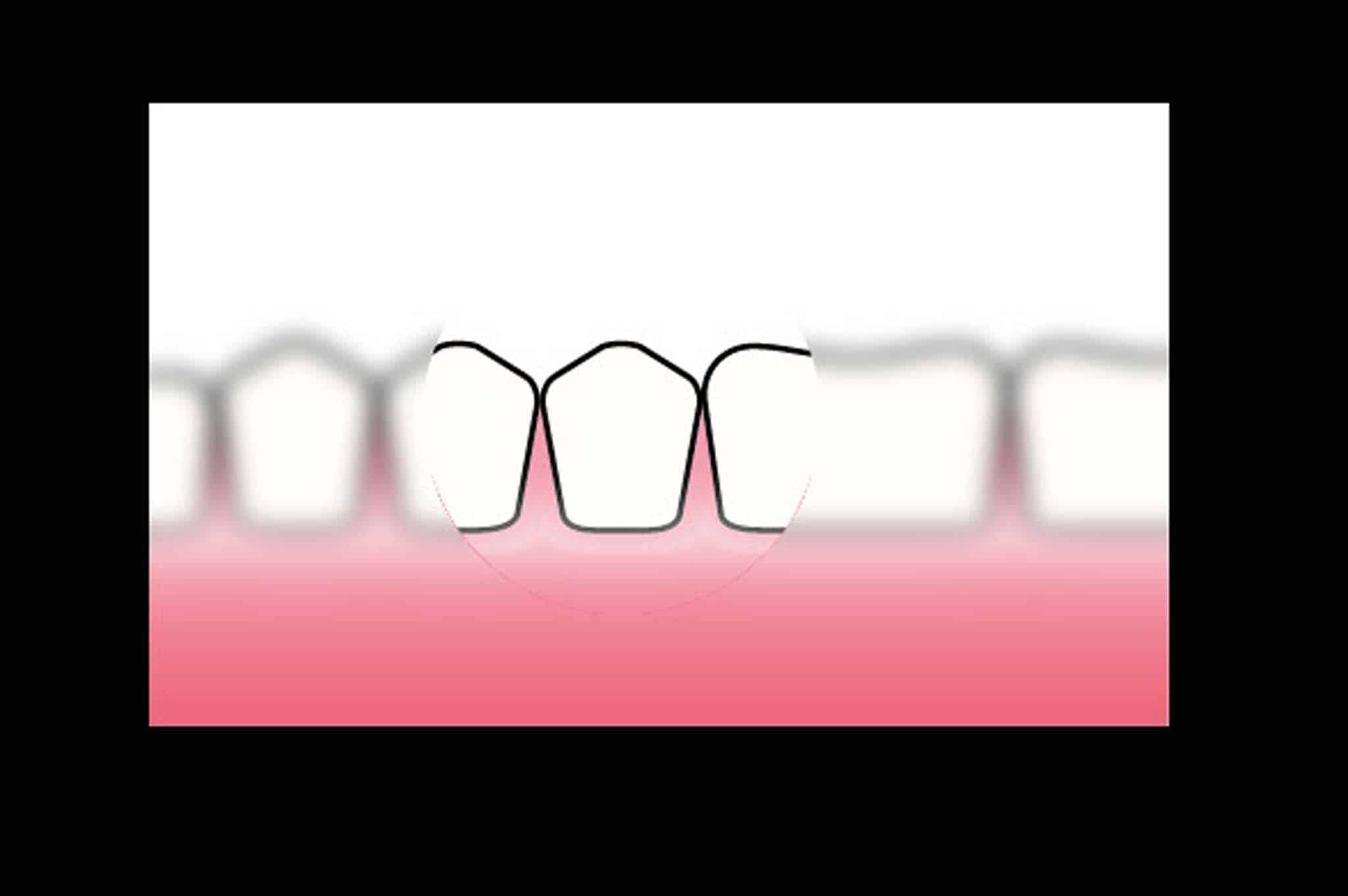 Før- og etterbilde: Mikroskop brukt ved Kolbotn Tannklinikk gir tannleger i Kolbotn og Follo enestående presisjon.
